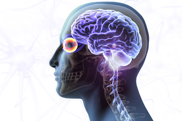 Opticomyelitis (ziekte van Devik): wat is het, symptomen, behandeling, prognose?