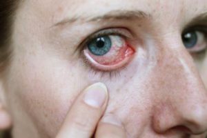 Infektion mit Parasiten