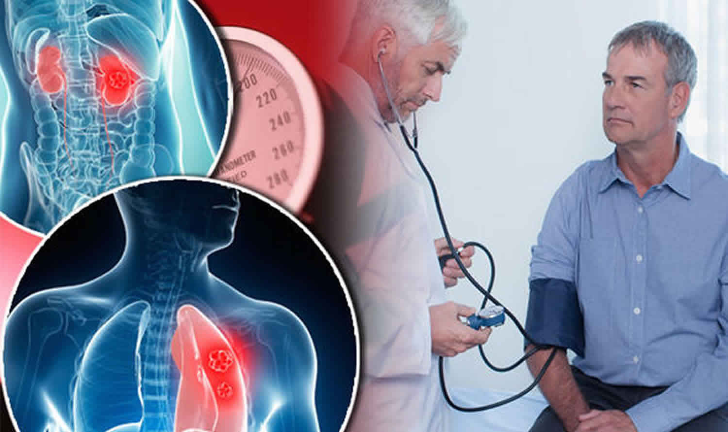 Goodpature-Syndrom: Was ist das, Symptome, Behandlung, Prognose?