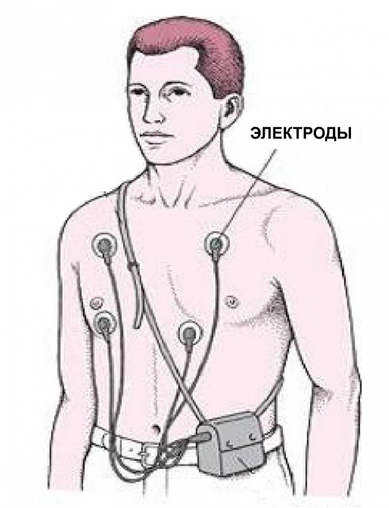 Un suivi quotidien Holter ECG: indications et caractéristiques
