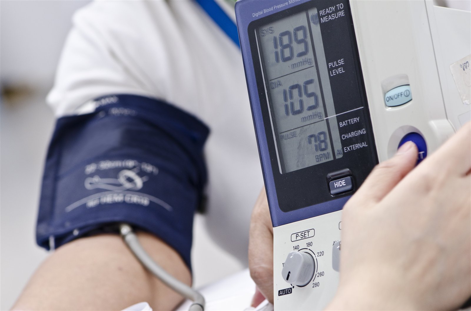 El infarto de miocardio: los síntomas, diagnóstico, tratamiento y atención de emergencia para un ataque al corazón