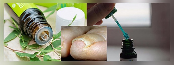 Zelenka z grzybicy paznokci: recenzje, leczenie