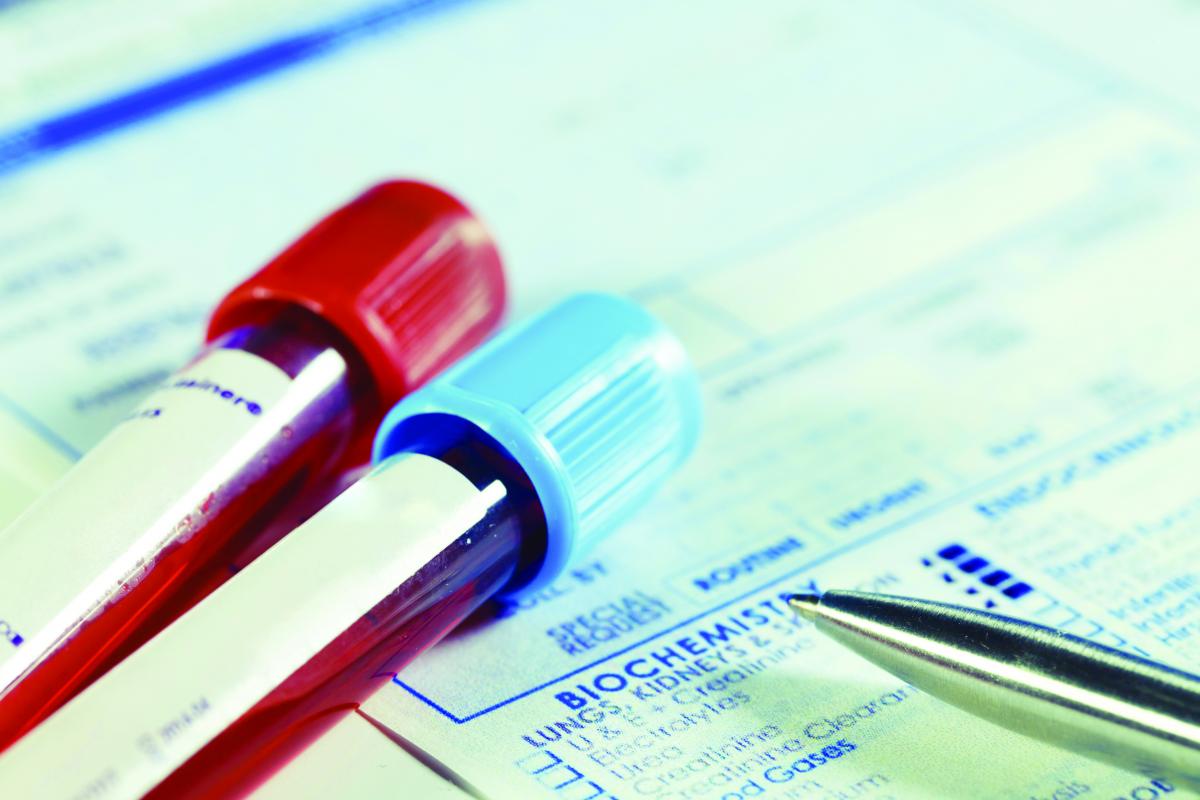 marqueur tumoral CA 125: norme et décodage des résultats des tests sanguins