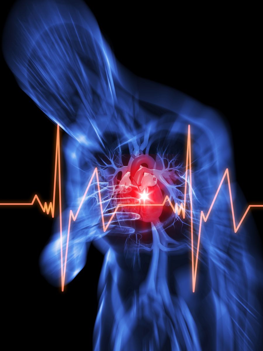 Sudden cardiac arrest: causes, signs, symptoms, first aid