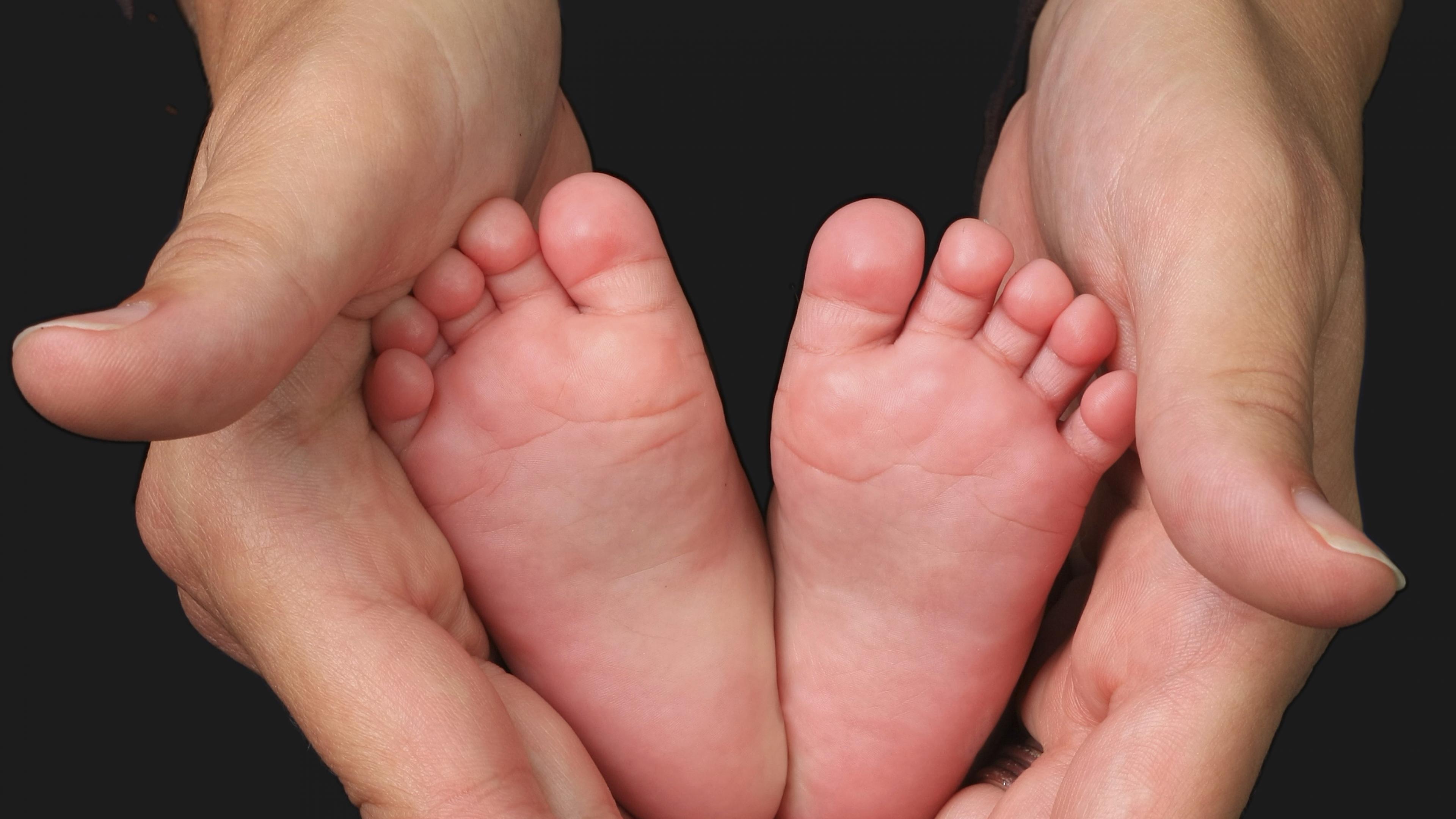 Valgo deformità del piede nel bambino: cause, diagnosi, trattamento