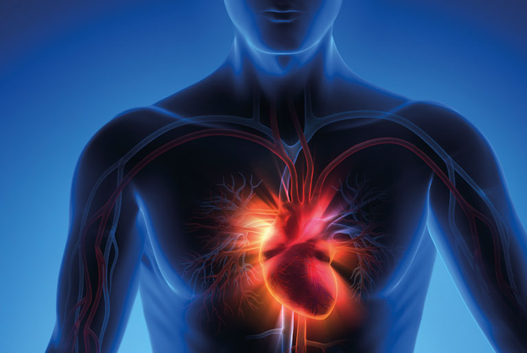 Myocardial infarction: what is it, symptoms, treatment, consequences
